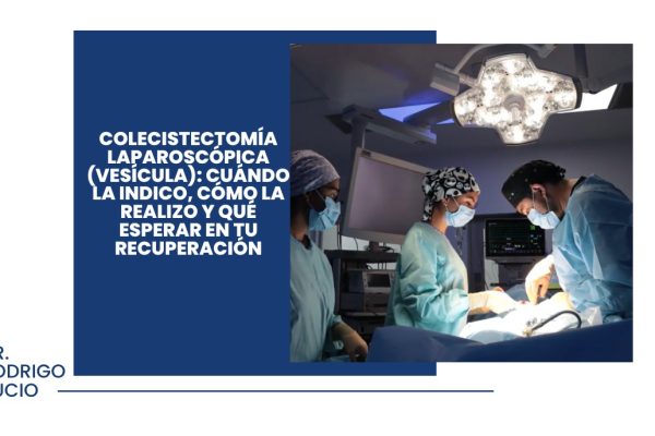 Colecistectomía laparoscópica (vesícula): cuándo la indico, cómo la realizo y qué esperar en tu recuperación