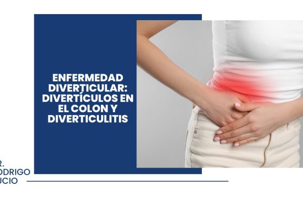 Portada Enfermedad Diverticular Diverticukis en el colon y diverticulitis